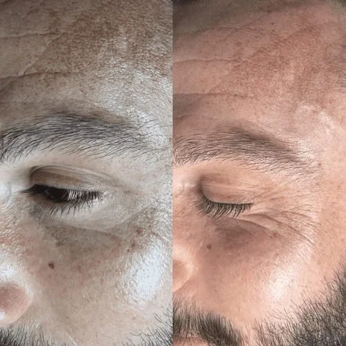 Close-up of two different faces with visible skin textures and eyebrow details, split down the middle.