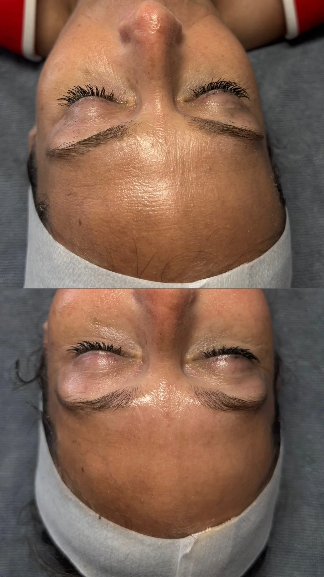Close-up of a woman receiving a facial treatment with her eyes closed, showing before and after images of her skin, which appears smoother and more refreshed in the after image.