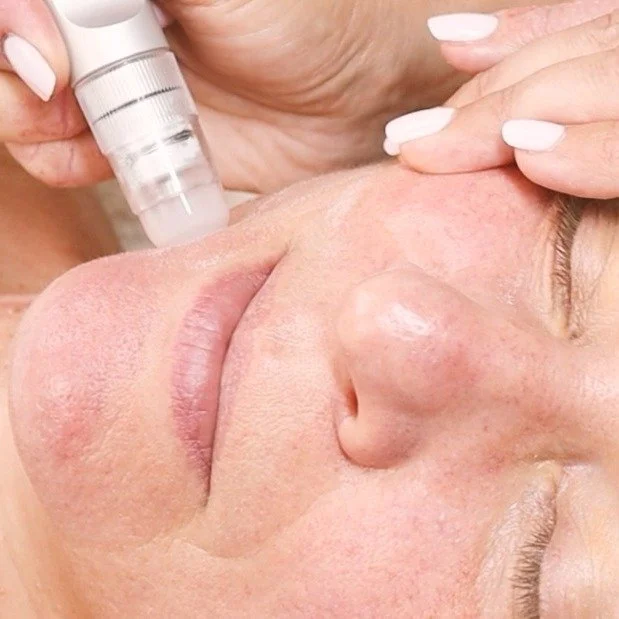 Clients love instant results — and that’s exactly what Dermavisage Crystal delivers.
This advanced microdermabrasion system uses a fine jet of crystals to exfoliate and polish the skin, stimulating cell renewal and revealing a brighter, m
