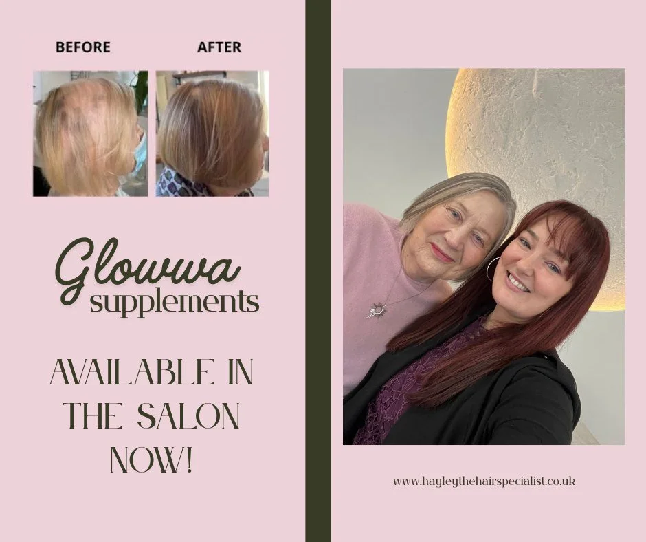 ✨ A Story That Truly Touched My Heart ✨
I recently had the absolute pleasure of meeting Jane in person.  A woman who has spent over 20 years struggling with hair loss. She shared how deeply it had affected her confidence&hellip; to the point where sh