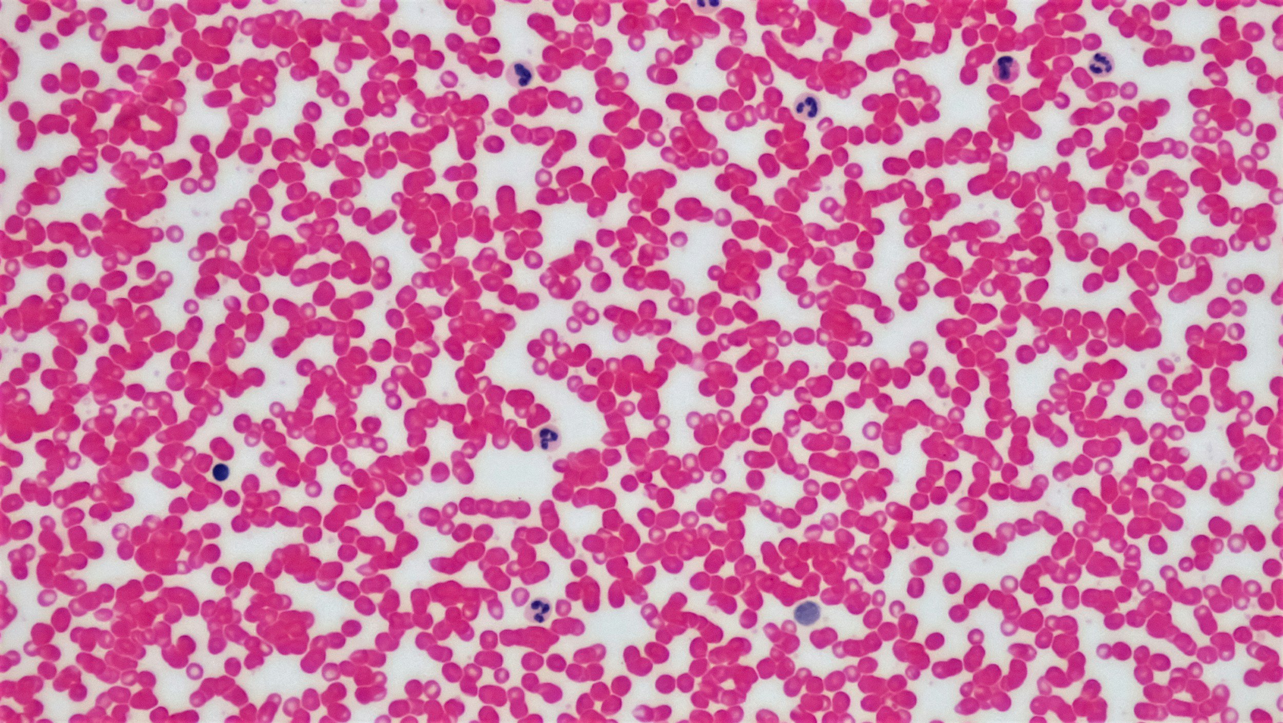 My Dog Tested Positive for Anaplasma—What Happens Next?