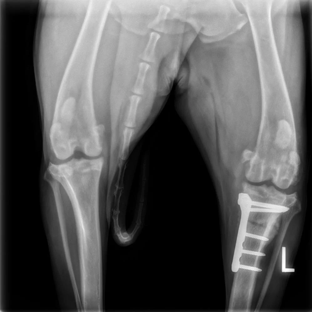 The Spring Spike—Why Knee Injuries Surge in April