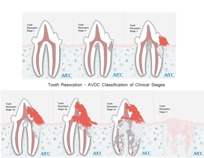 Feline Tooth Resorption: What Every Cat Owner Should Know