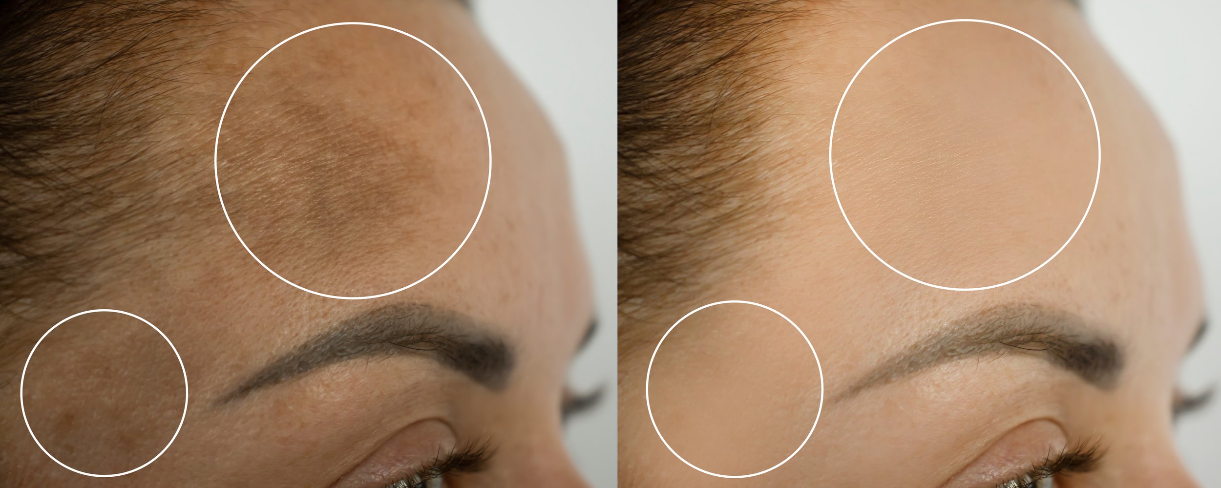 Reduce sun damage and pigmentation.