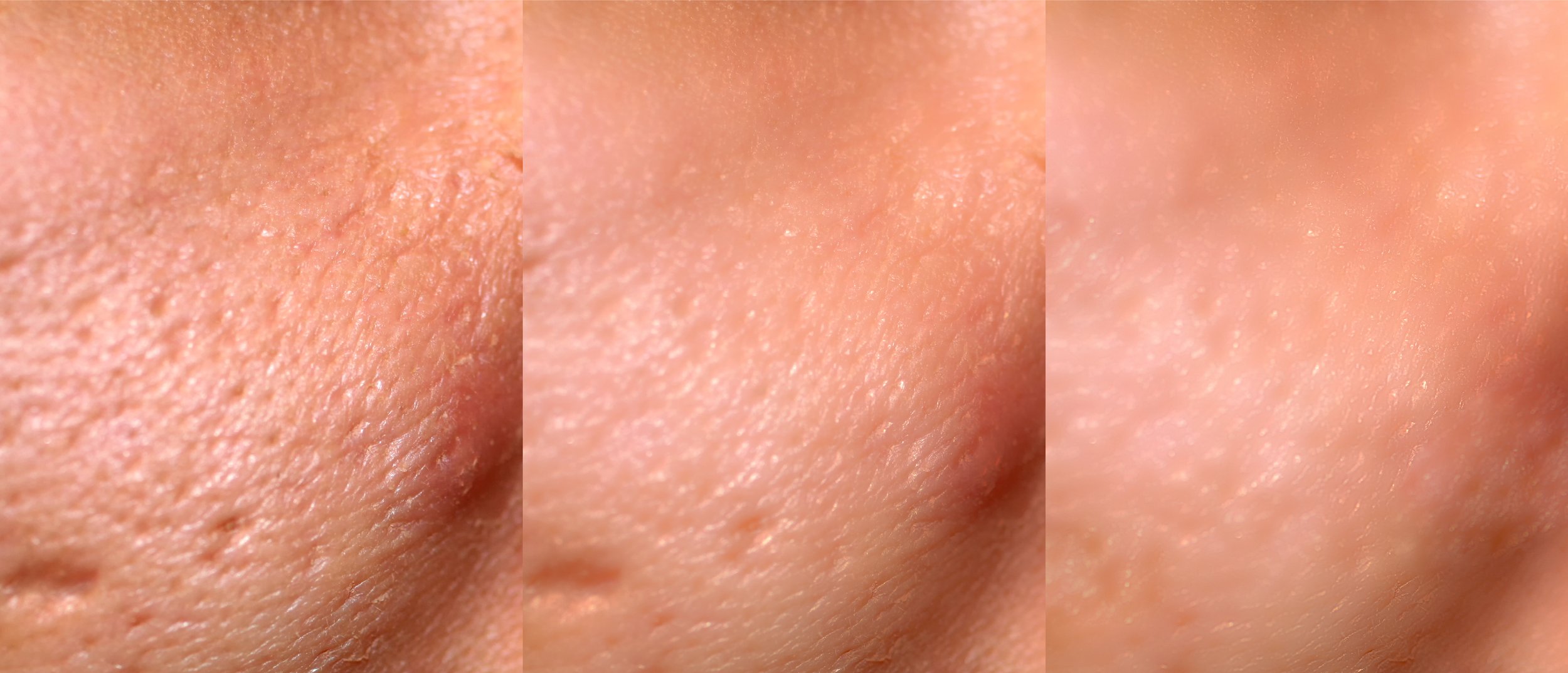 Enhance skin texture and smoothness.