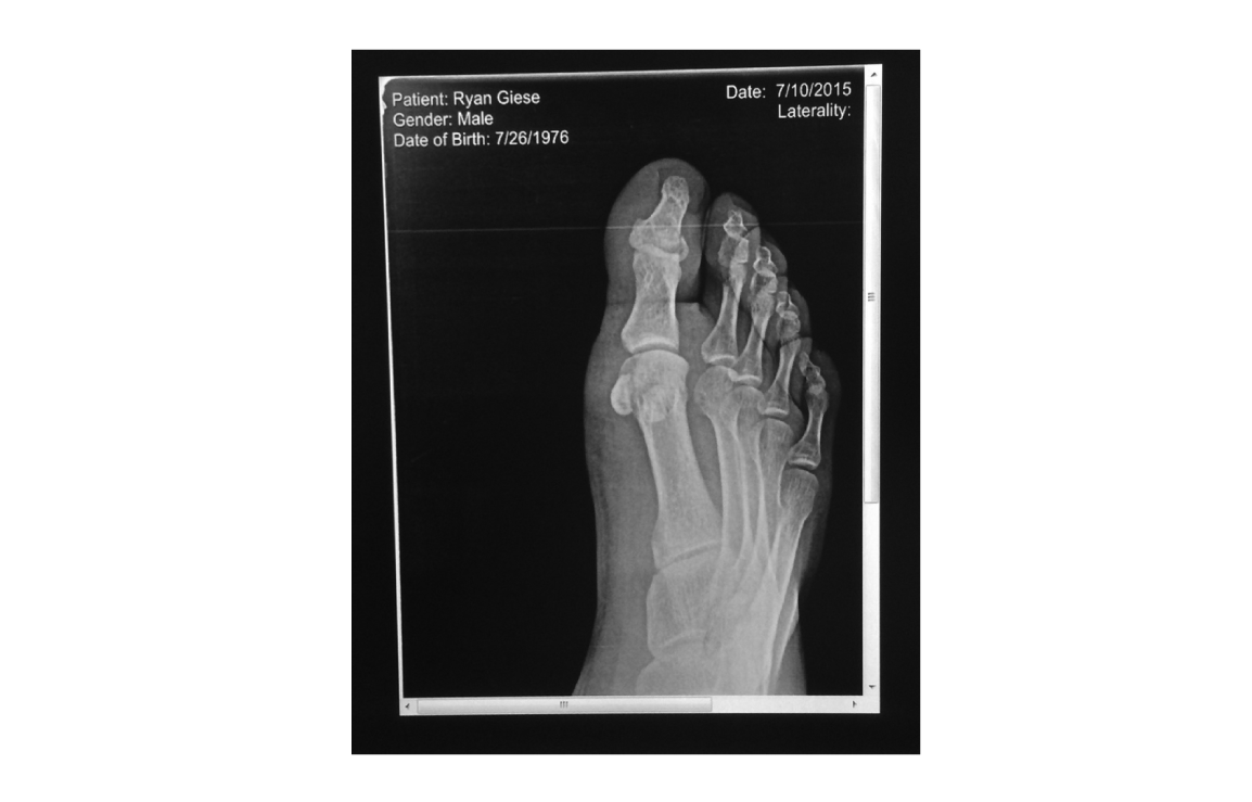 x-ray.png