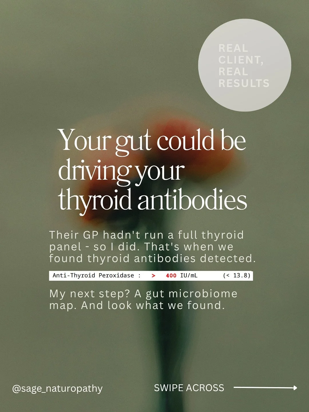 When the gut microbiome is out of balance, the immune system stays in a constant state of alert. Overtime, that chronic immune activation and inflammation can drive autoimmunity, including thyroid antibodies.

This is why when I see thyroid antibodie