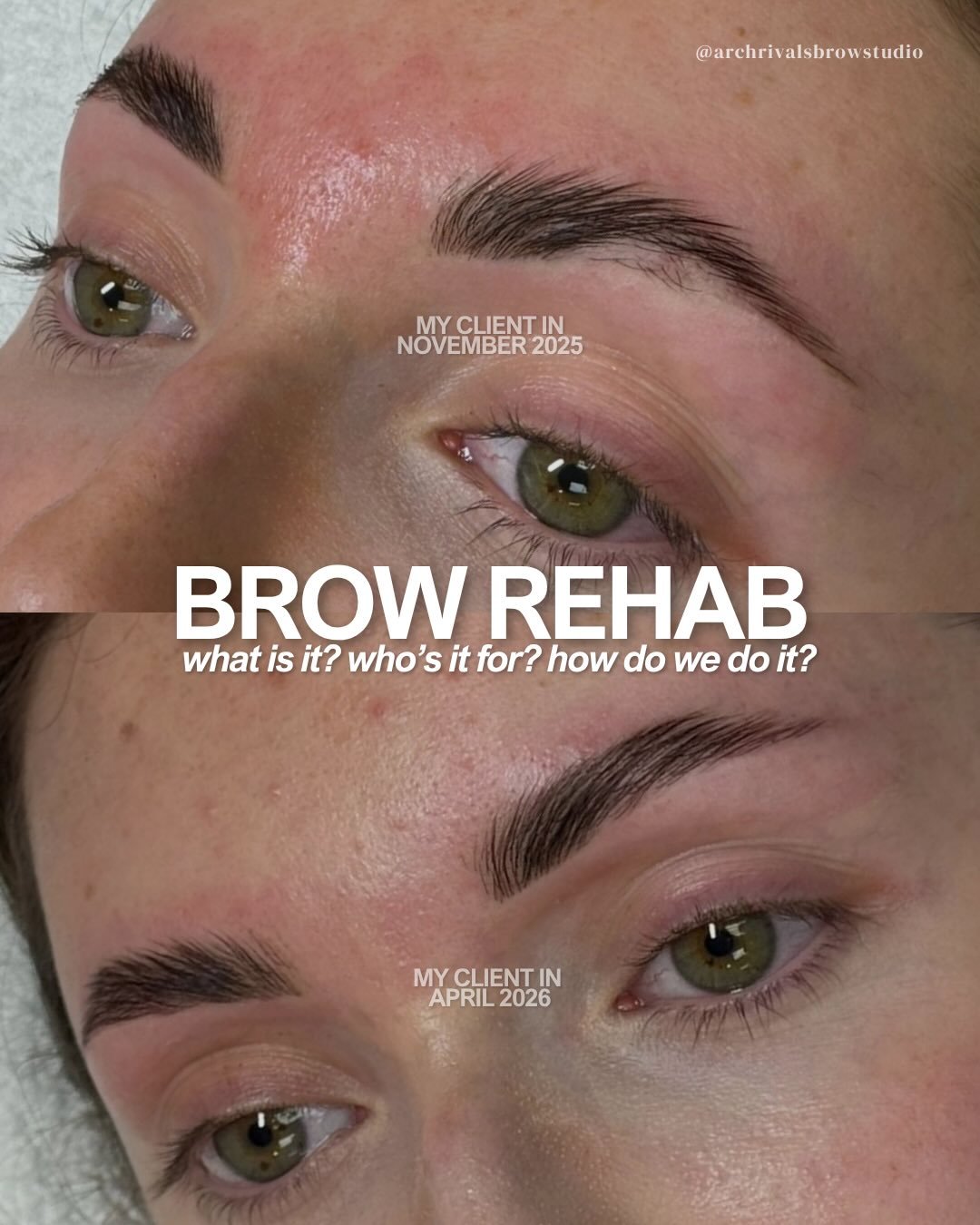 BROW REHAB or one less lonely brow hair? 😭🤞

brow rehab can be successful if both parties have trust in each other and in the process! i&rsquo;ve seen it work with my own eyes! 

✨if you need help with the plan to get your brows to grow out, I&rsqu