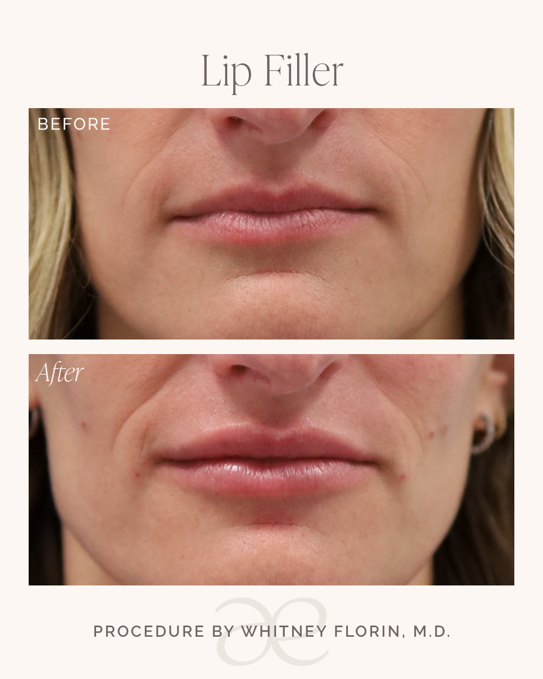 AES_BeforeAfter_Horizontal.png