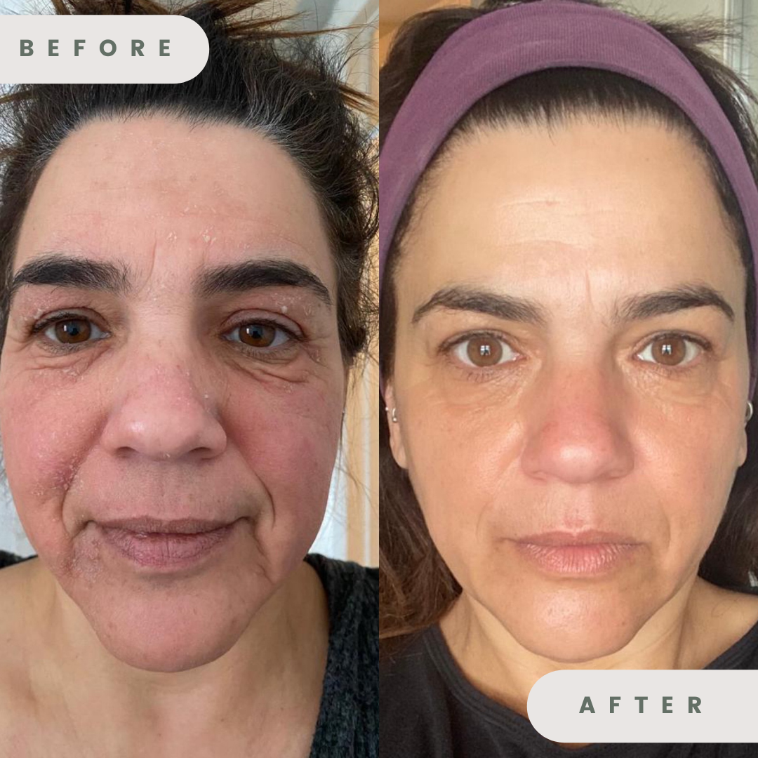 Tina before and after.PNG