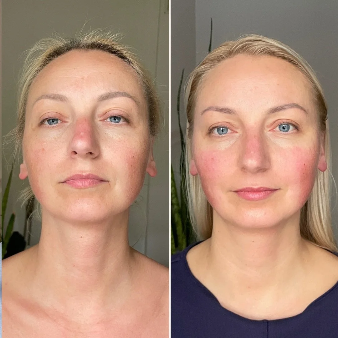 Sandriņa paver durvis un saka: &ldquo;zini ko, man Tev sakāms liels paldies! Man tāda sajūta, ka es pilnīgi tāda savādāka. Ļoti ļoti ļoti skaista! 😄&rdquo;

Ahh, mīļās, lai mirdzuma jūsos no iek&scaron;iņas uz āriņu un no āriņas uz iek&scaron;iņu ✨❤