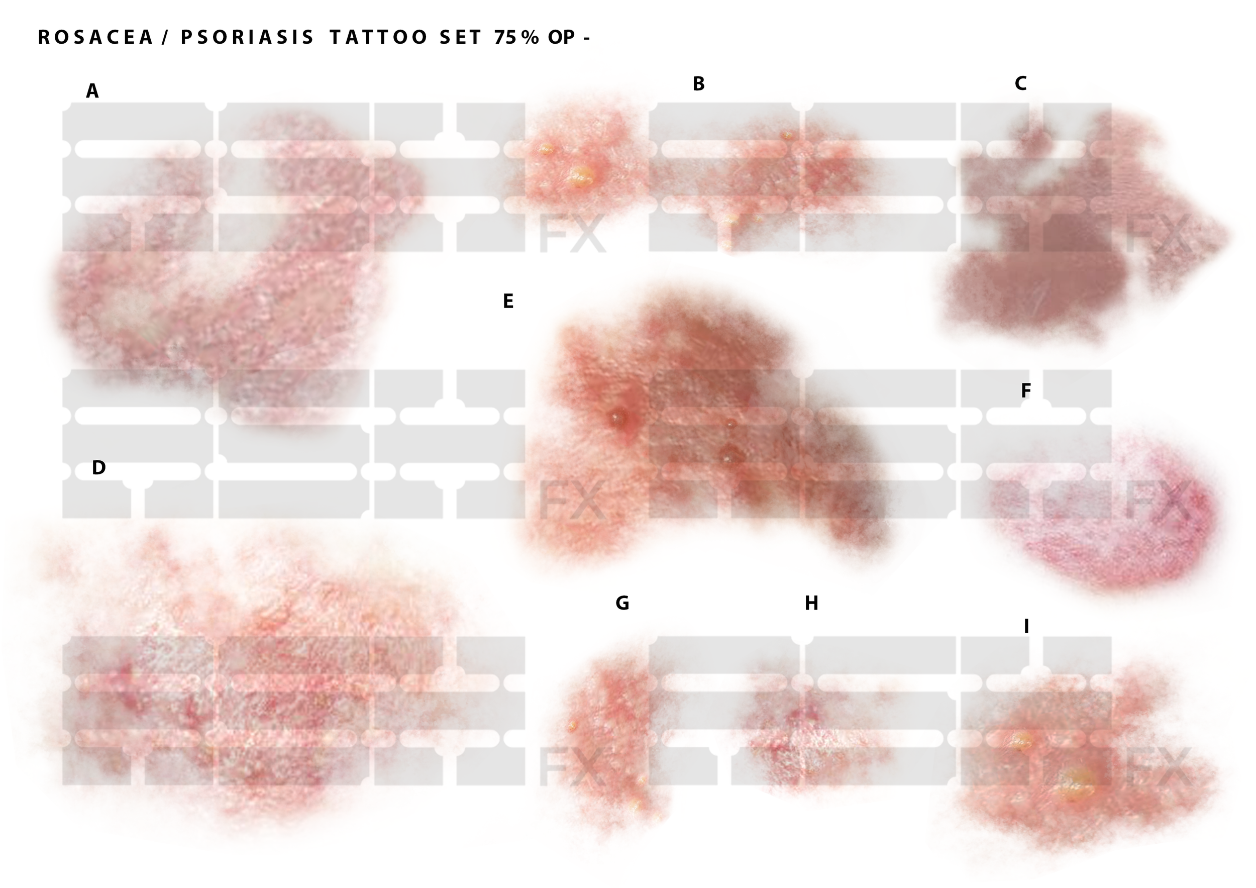 ROSACEA WATERMARK.png