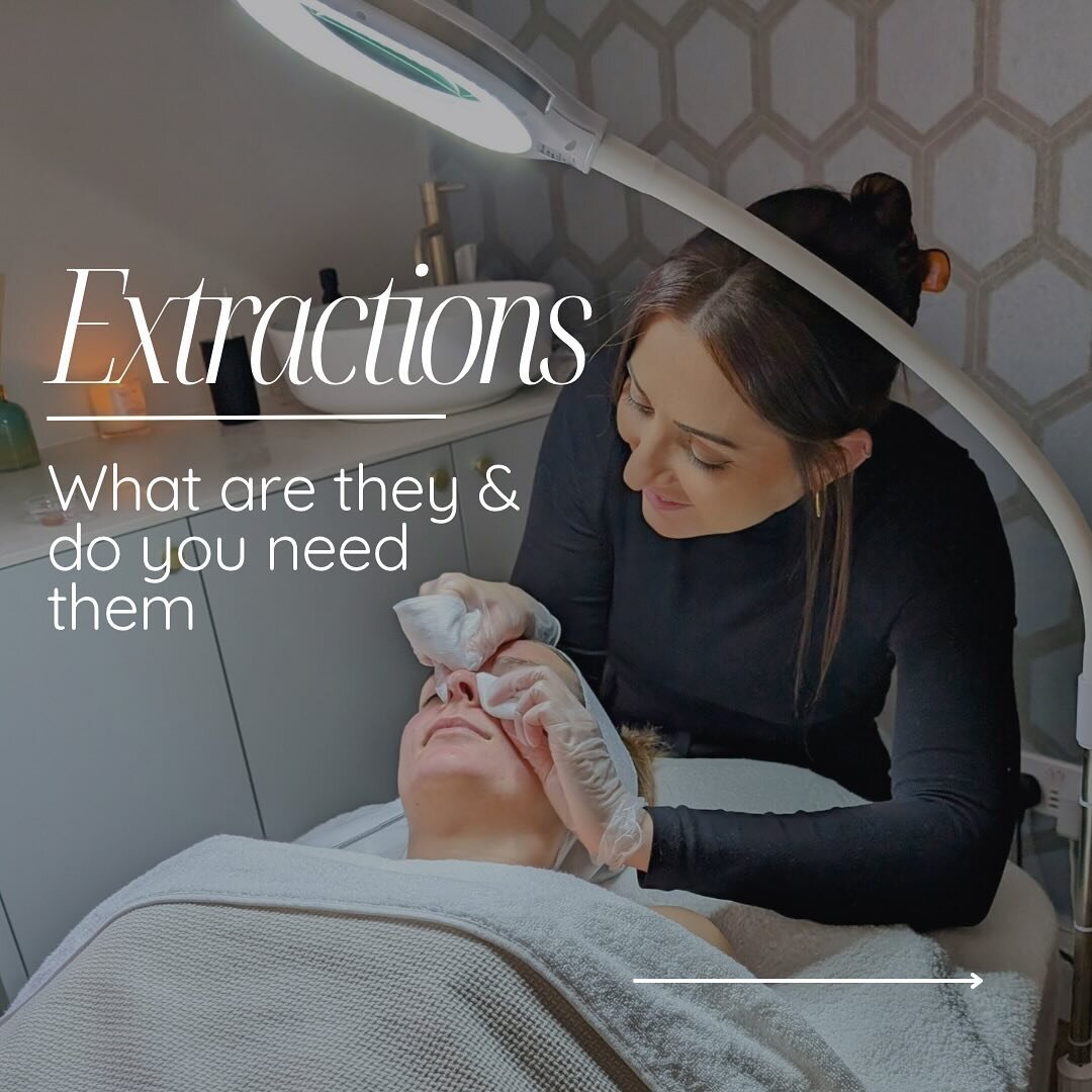Extractions&hellip;.The necessary evil for removal of congestion &amp; blackheads 💀

Yes, it can be an eye watering process, BUT when performed correctly the short lived pain is so worth the long-term gain! Benefits of regular extractions include: 

