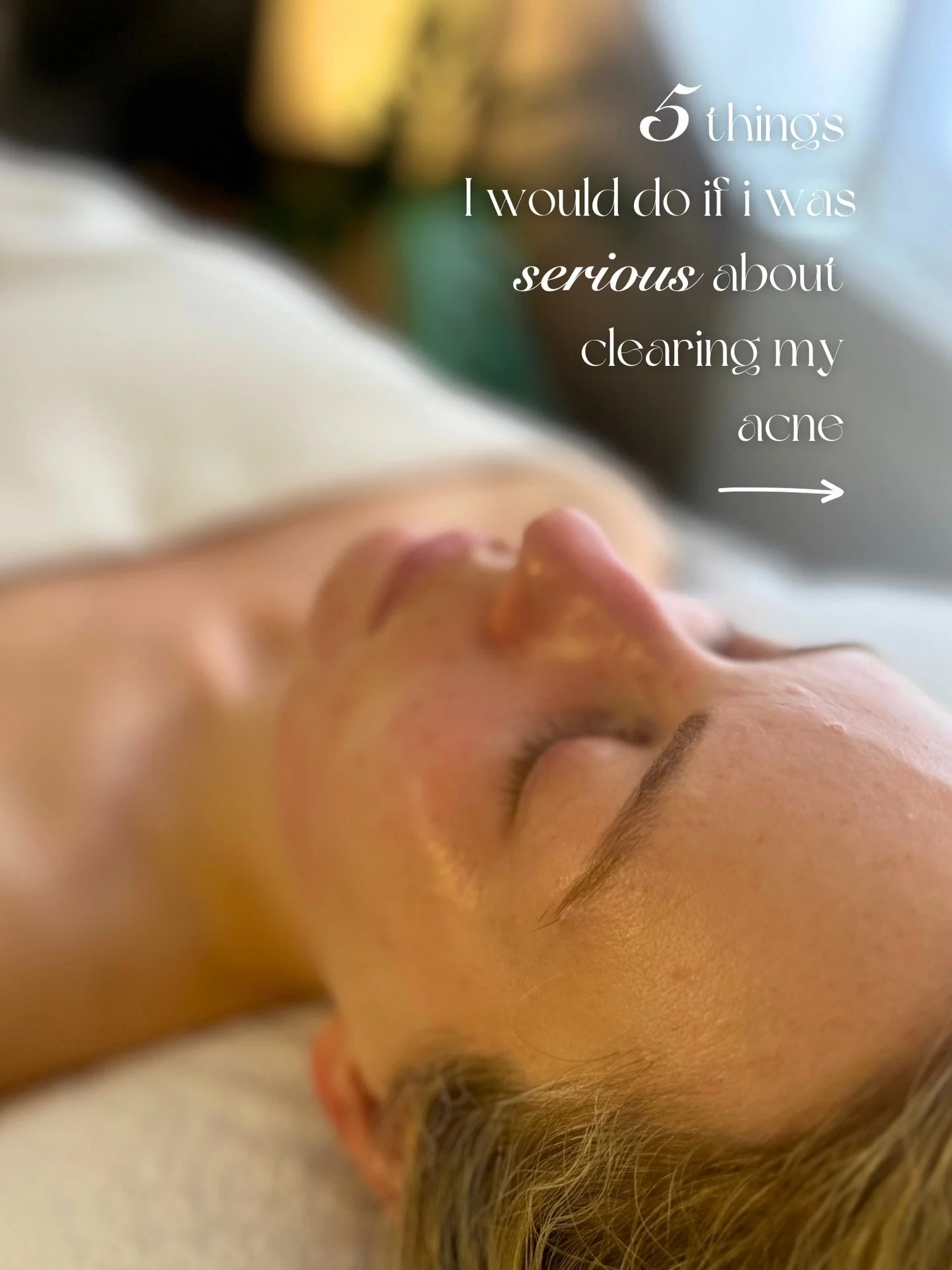 Wanting to heal your Acne? ✨

Here&rsquo;s what I would prioritise to clear my skin 🤍