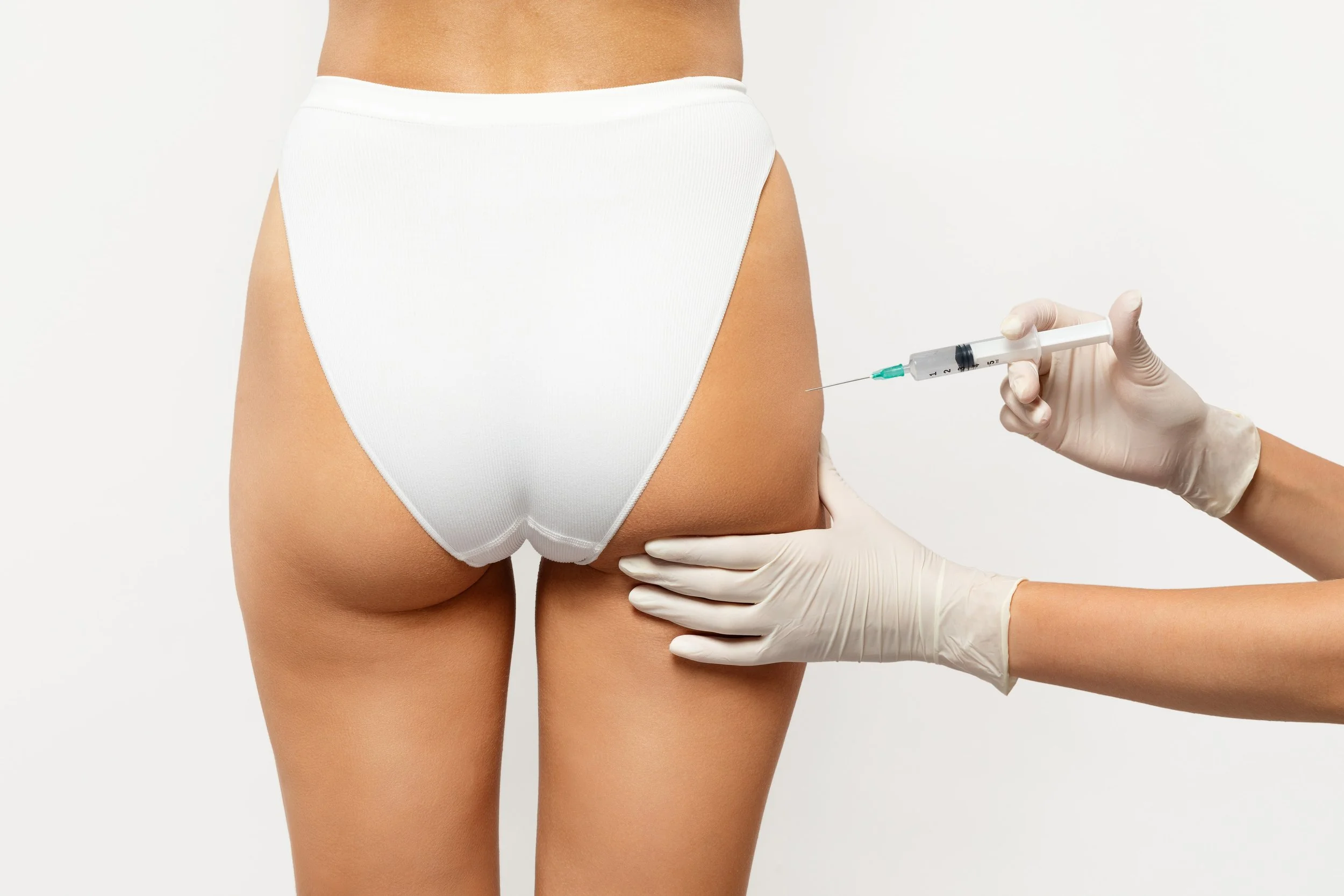 remodelare fese acid hialuronic