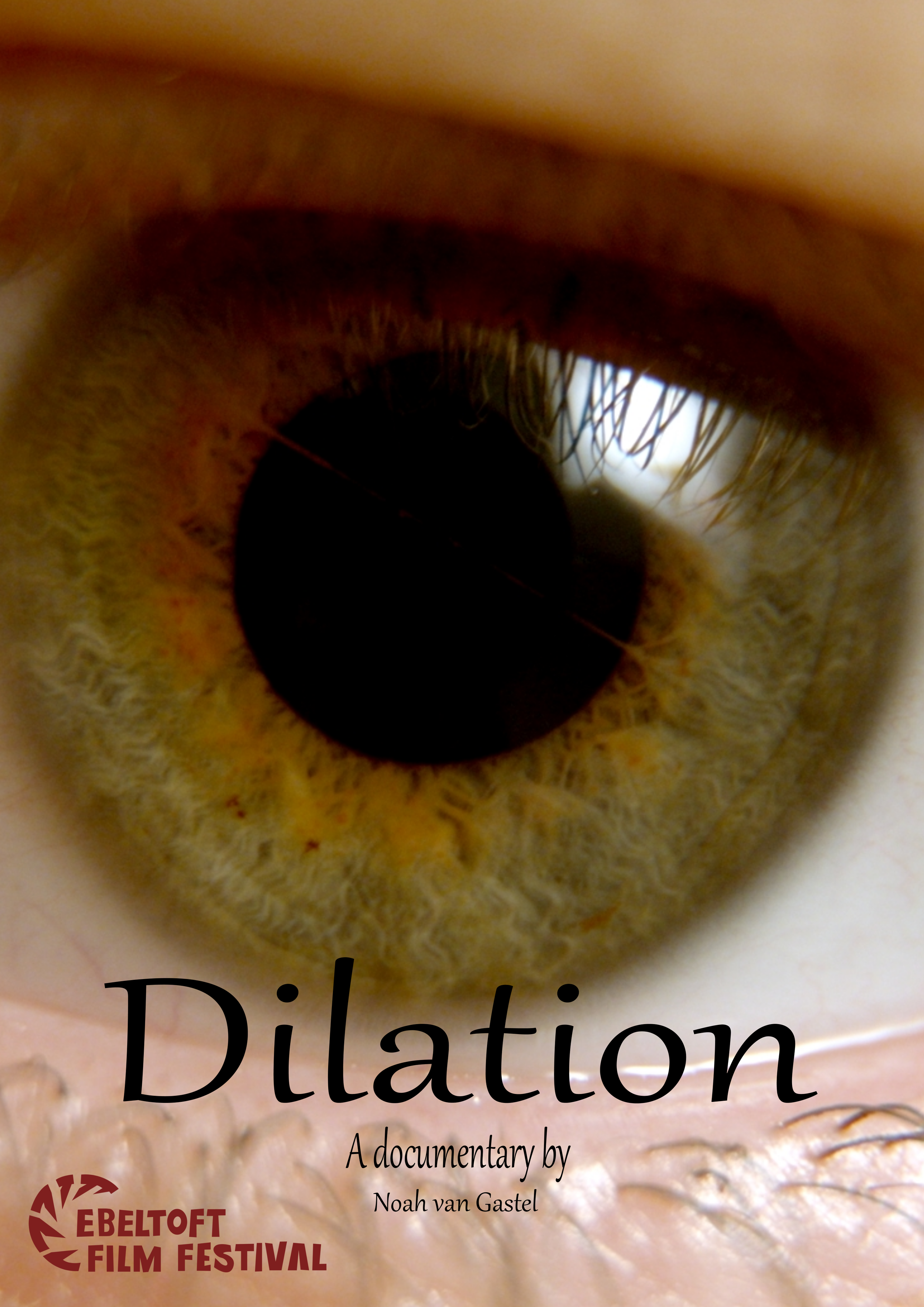 Dilation
