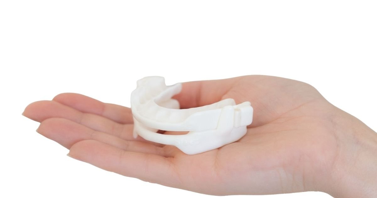 Hand holding a custom mandibular advancement splint used to treat snoring and obstructive sleep apnoea by keeping the airway open during sleep.