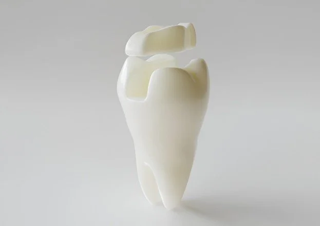 Can a Damaged Tooth Be Repaired Without a Crown
