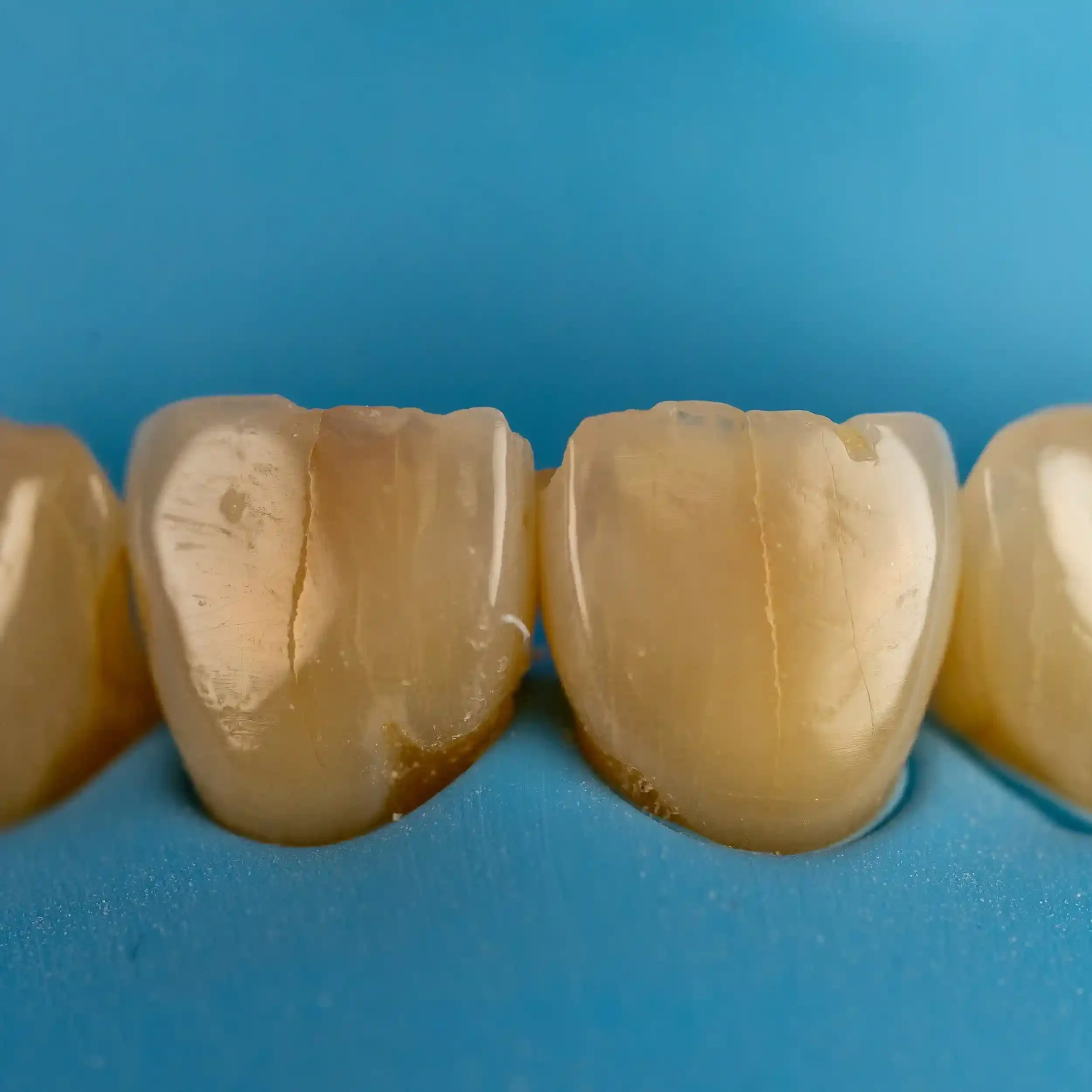 A close-up of teeth.