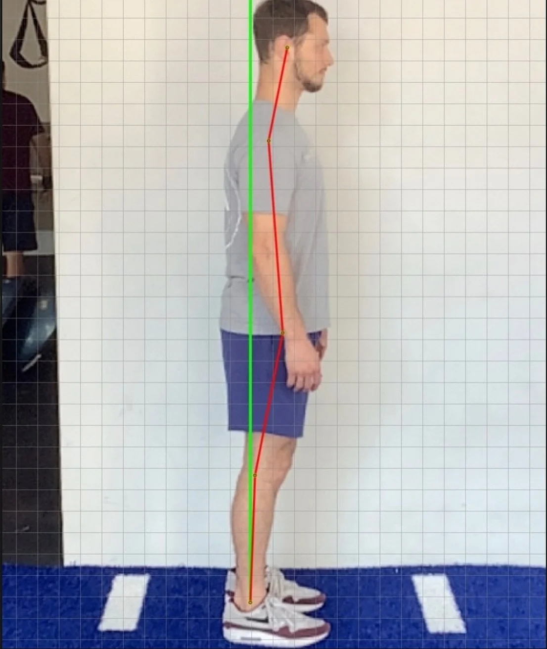 This side view posture screen shows a forward head shift—a common pattern we see in today’s tech-driven world.
Even just 1 inch of forward head posture can add up to 10 pounds of extra stress on your neck and spine. π³ That’s like
