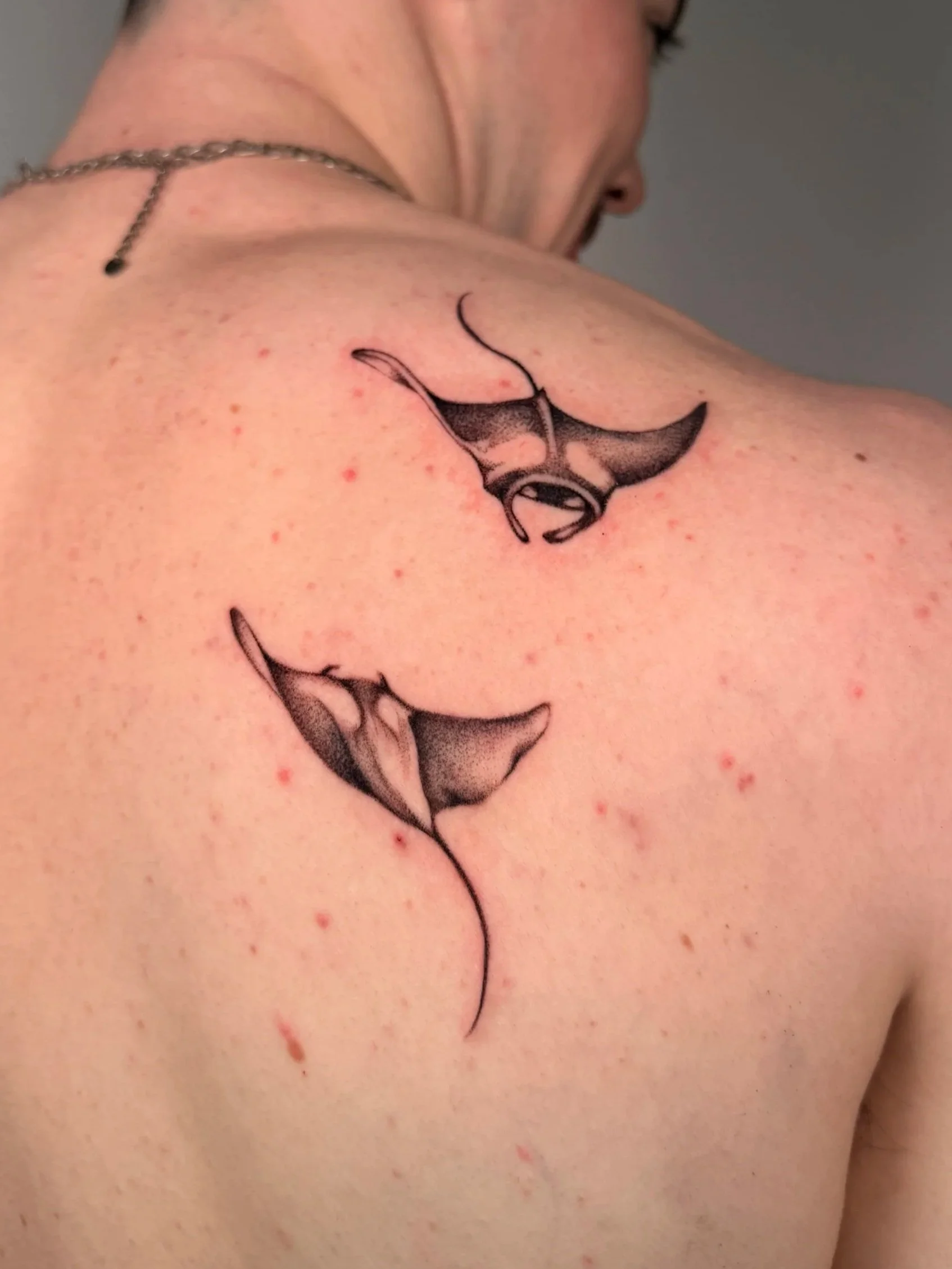 A flower-shaped tattoo on a person's shoulder, with black and gray details, surrounded by small bumps or skin irritations.