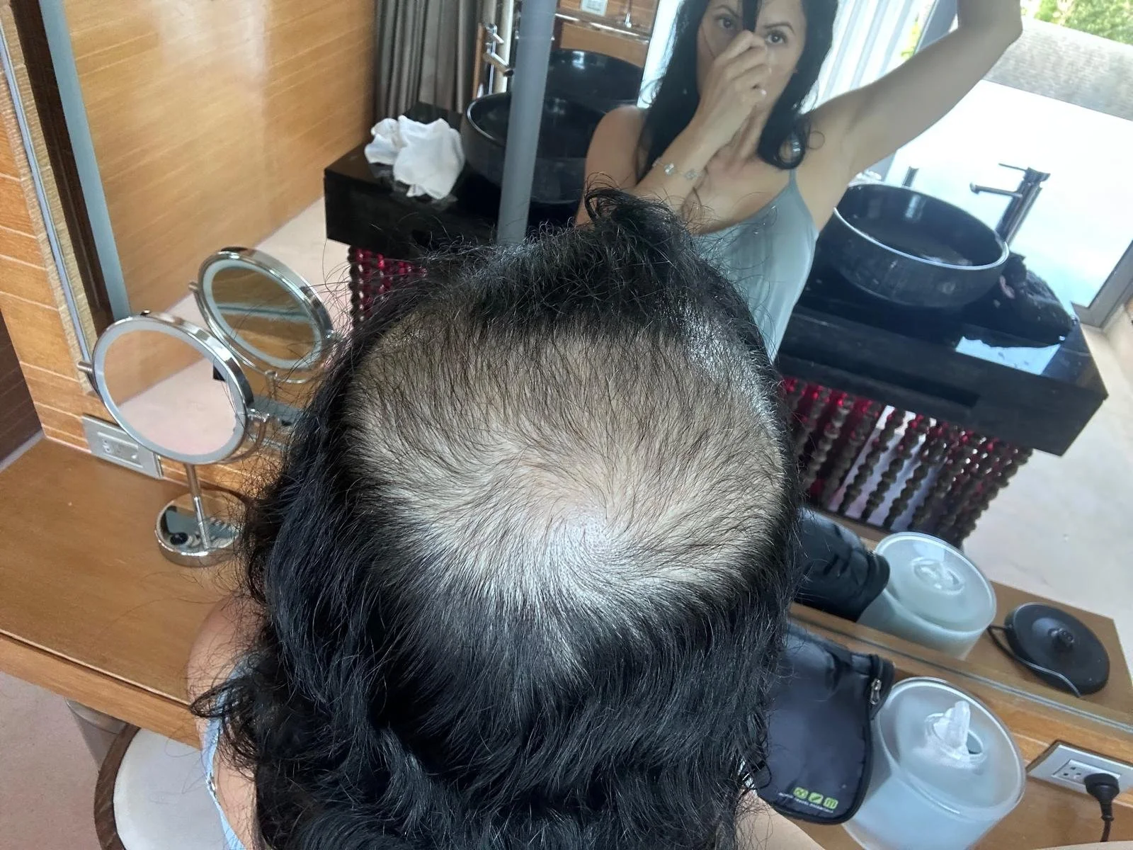 Overhead view of a person with thinning hair at a salon or barbershop, looking into a mirror with a woman in the background, covering her mouth with her hand and raising her arm. Kimberly's hair growth starting to come back