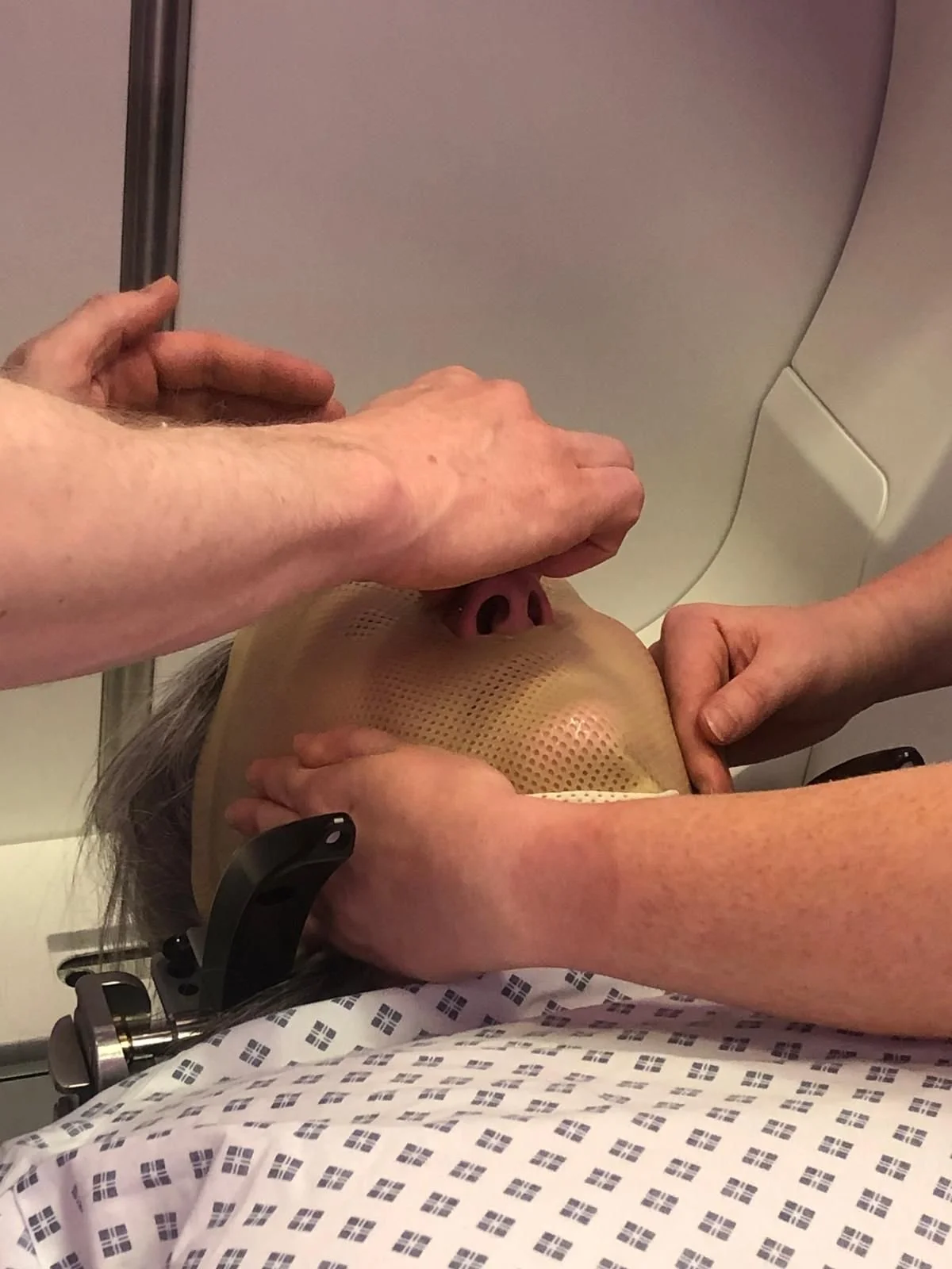 Nichol on a radiotherapy table, with a hospital gown on and radio therapy mask being fitted tightly around her face. This is to treat her lung cancer which metasasized to the brain.