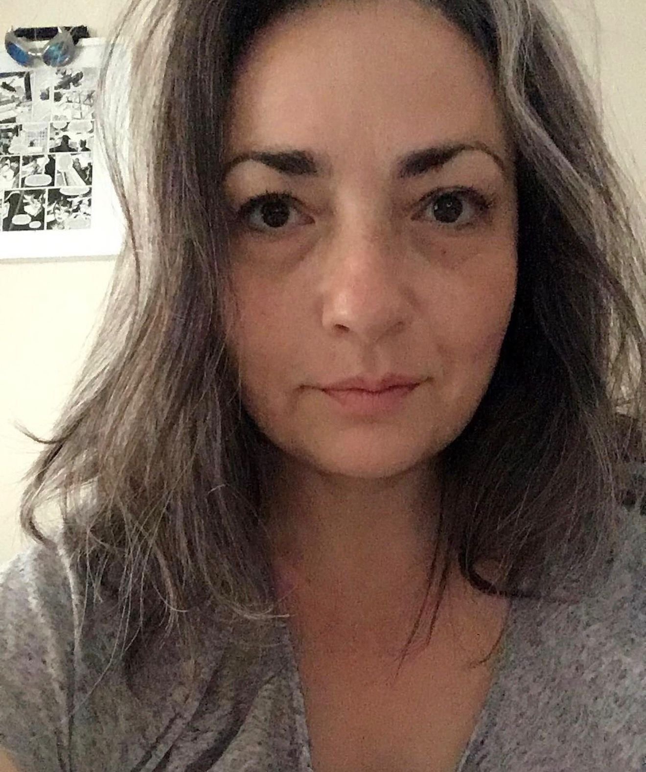 Close up of Nichol, neutral expression, looking pretty - after her diagnosis of stage 4 lung cancer.