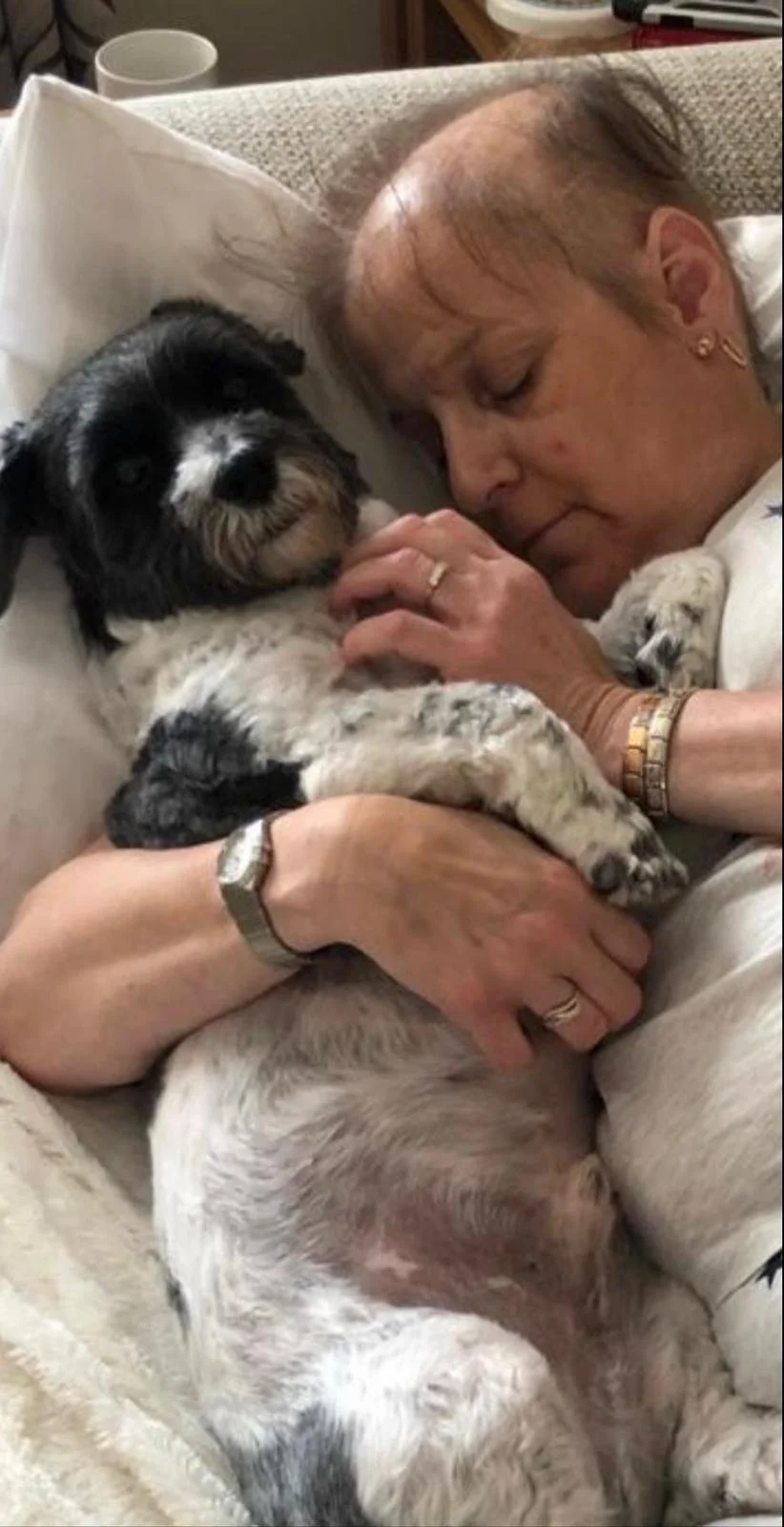 Julia curled up against her dog on a sofa. Julia is looking tired and has lost most her hair from chemo