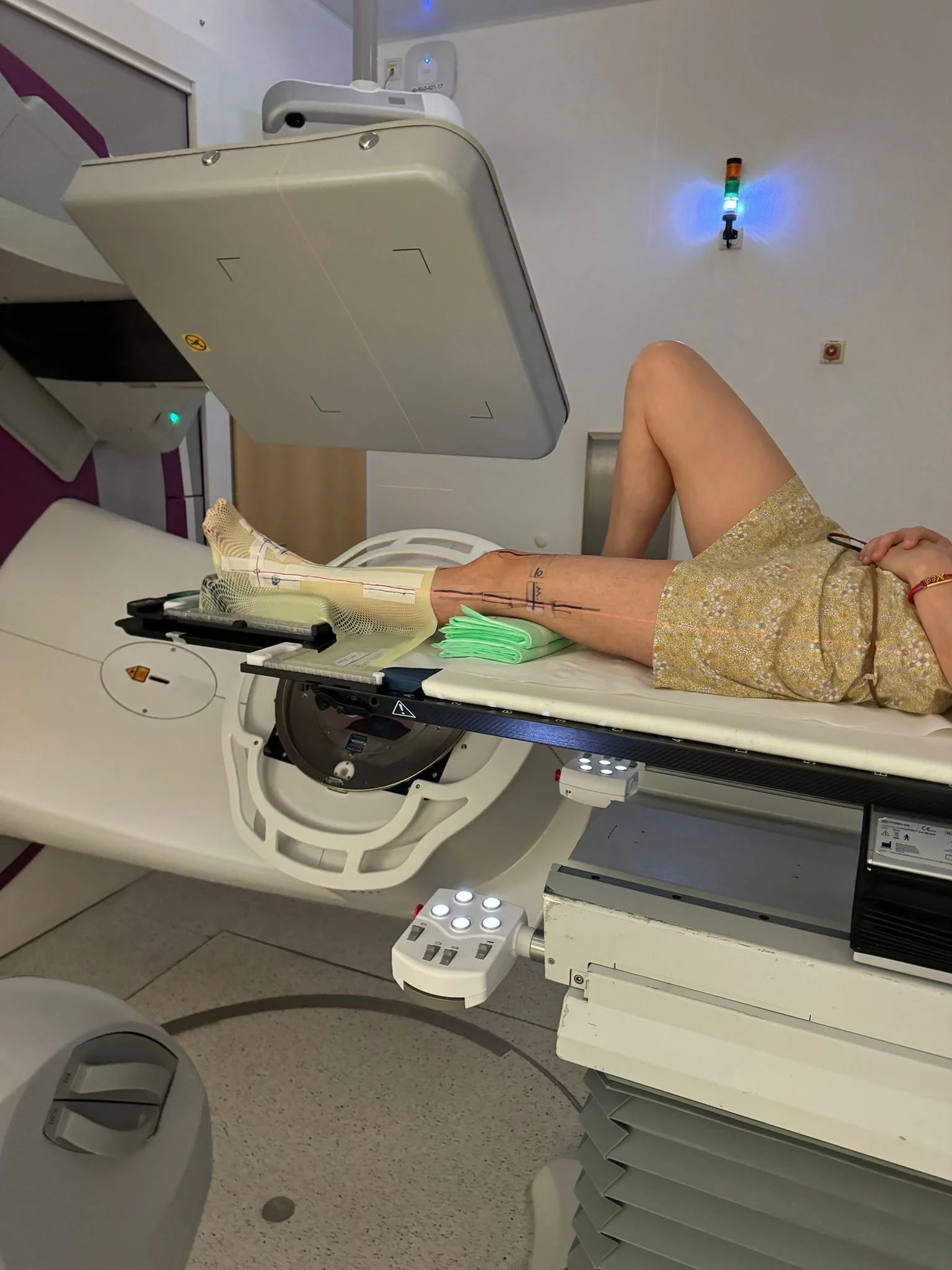Kathrin undergoing an MRI of her foot - where they found a malignant cancer tumour that turned out to be lung cancer.