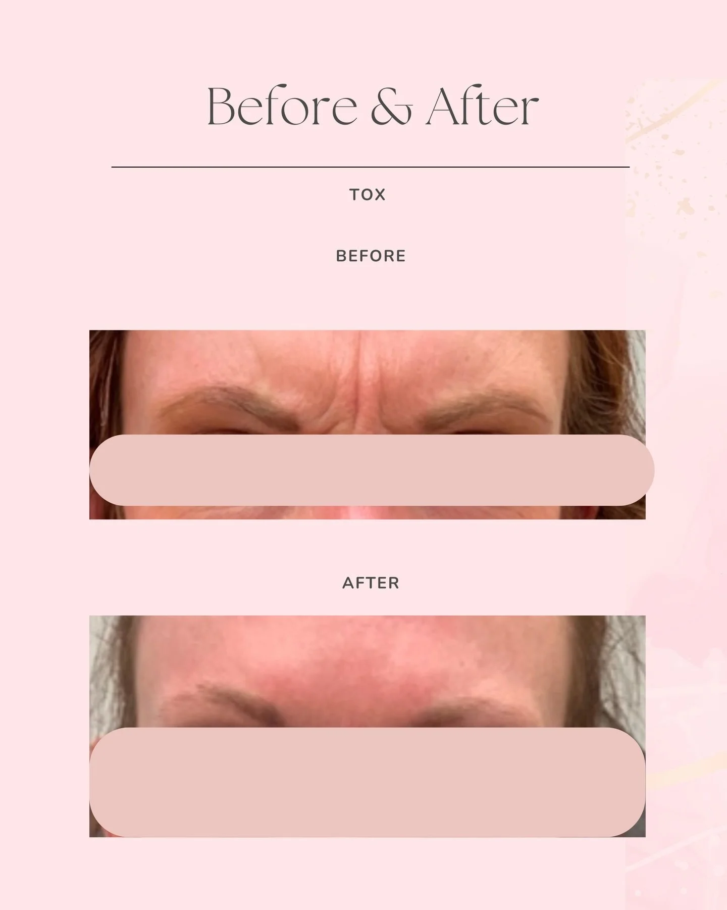 When your reflection finally matches that unstoppable energy you carry every single day. ✨  Let&rsquo;s be real: a little &lsquo;TOX isn&rsquo;t about hiding: it&rsquo;s about highlighting. It&rsquo;s that subtle, refreshed boost that makes you look 