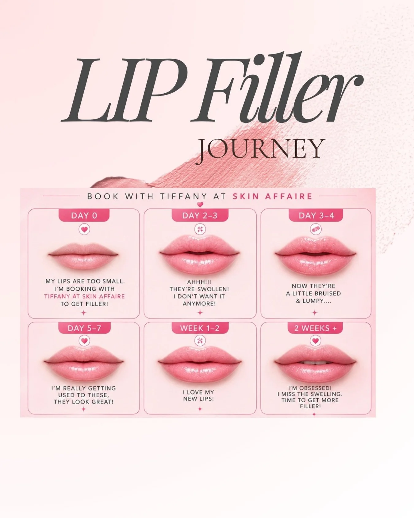 ✨ The Lip Filler Journey 💋
Thinking about lip filler? Here&rsquo;s something almost everyone experiences...
💕 Day 0: &ldquo;My lips are too small. I&rsquo;m finally doing it!&rdquo;
😳 Days 2&ndash;4: Swelling, bruising, and second-guessing your de