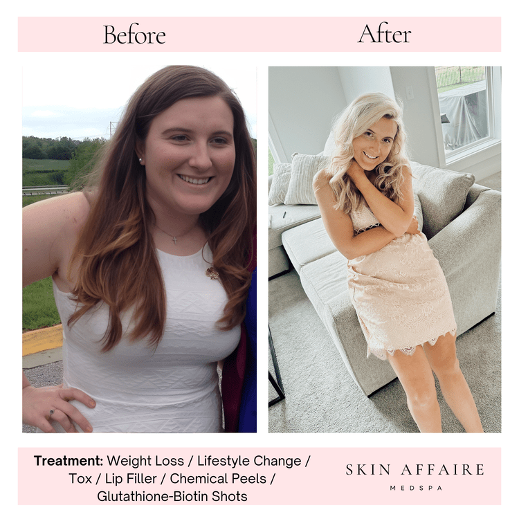 Medical weight loss results at Skin Affaire MedSpa in Excelsior Springs, MO