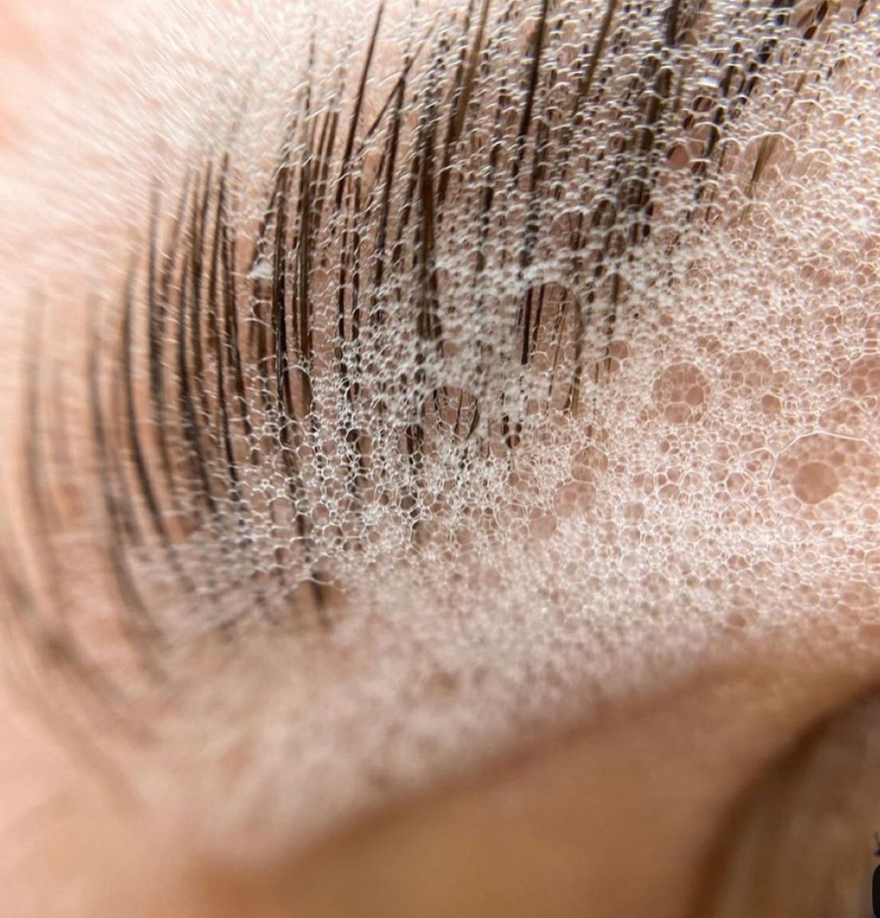 Prise de vue en gros plan de bulles de savon sur une peau humaine, probablement sur la partie inférieure d'une ligne de cils ou un autre petit élément facial.