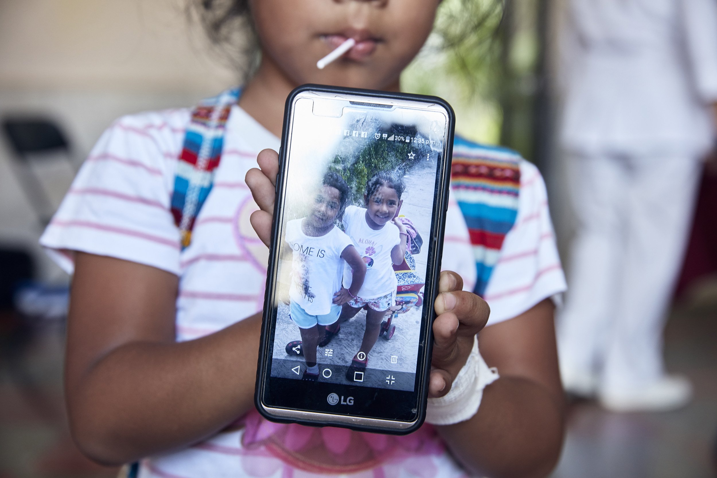 Mexico - Youth Camp Haemophilia