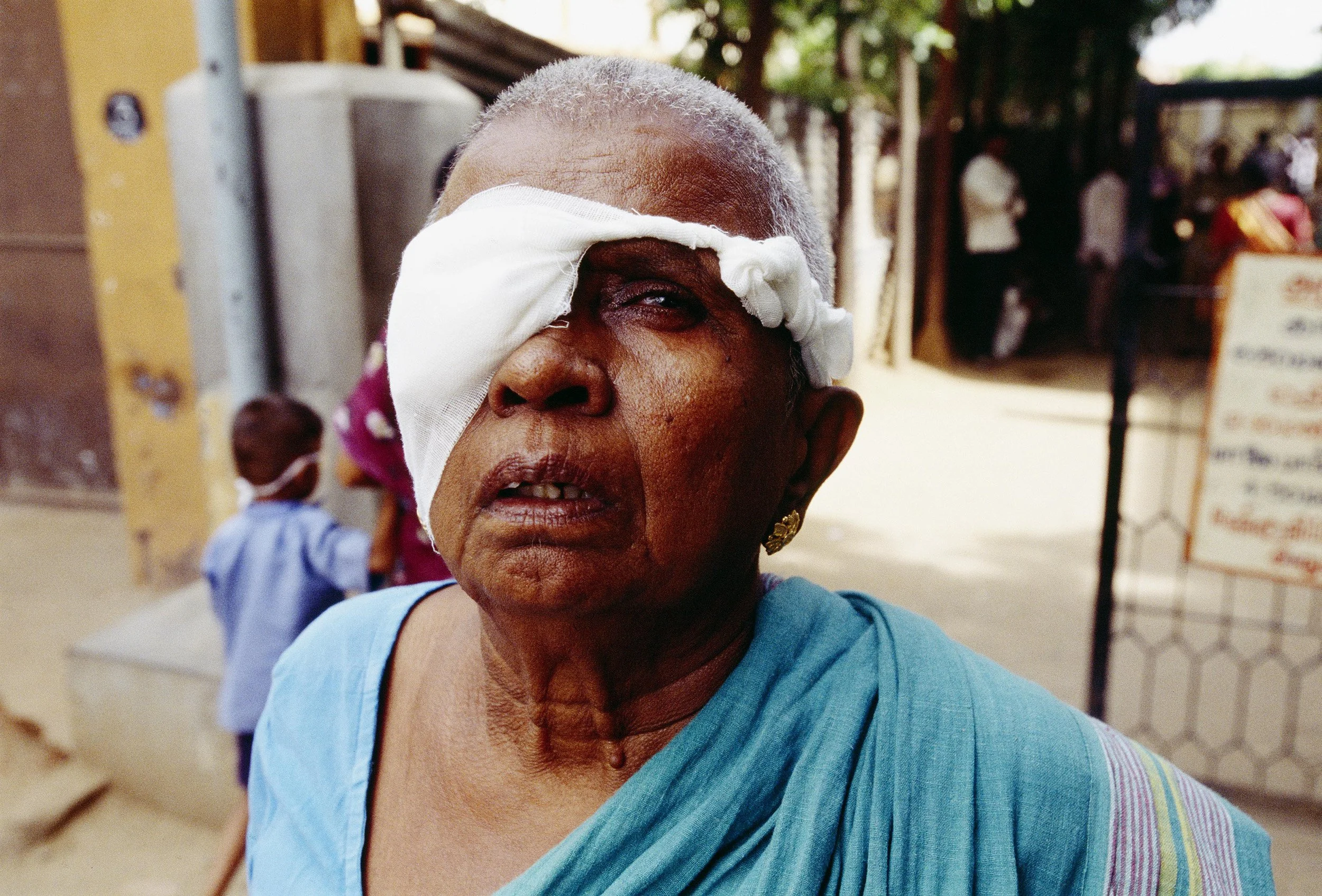 India - Arrevind Eyes Hospital