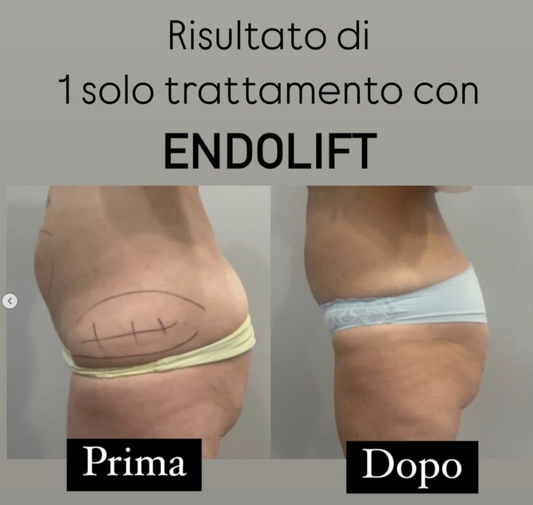 Screenshot 2025-06-27 alle 10.35.47.png