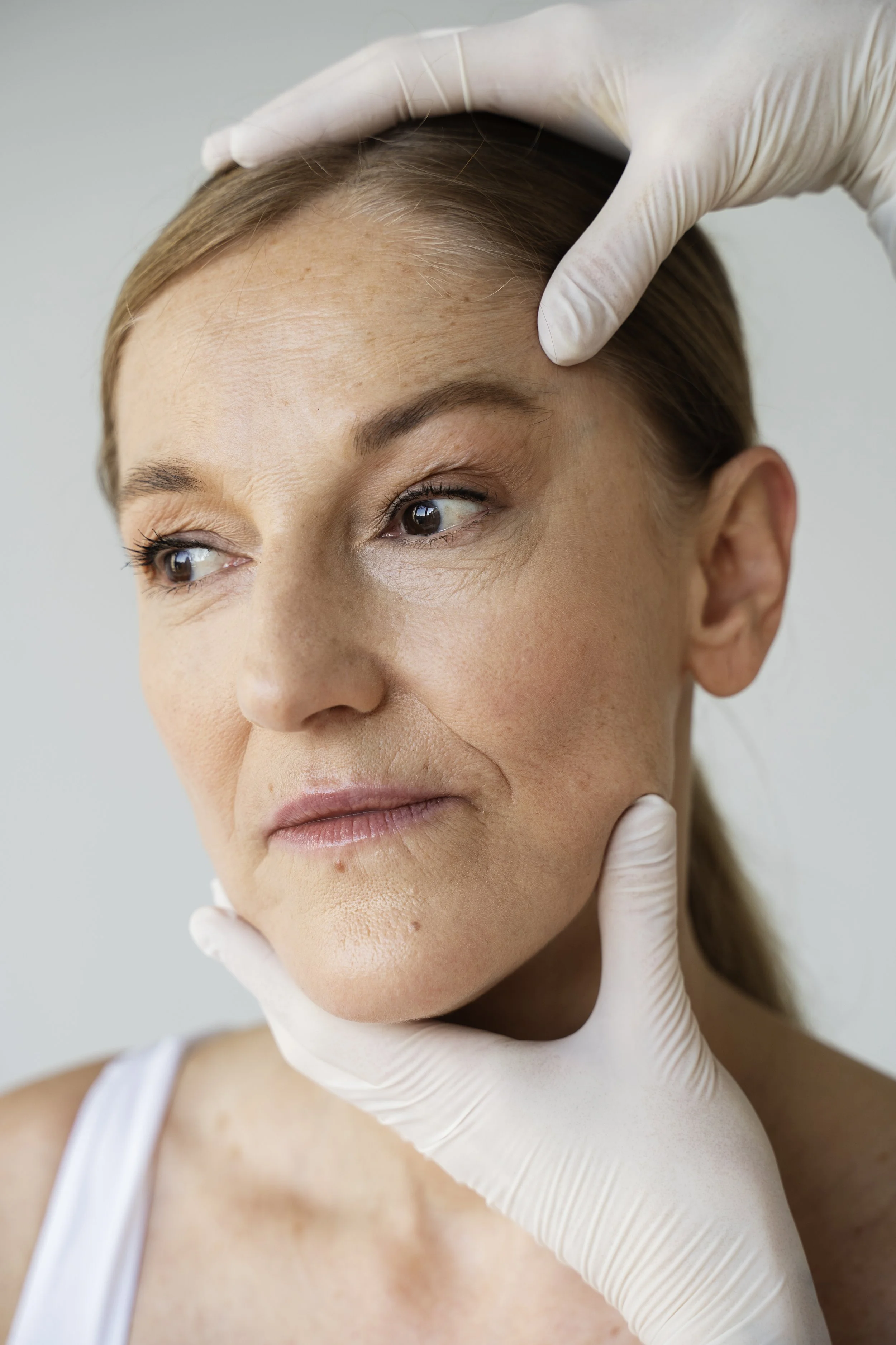 HIFU behandeling decollété bij vrouwen voor huidverstrakking en anti-aging