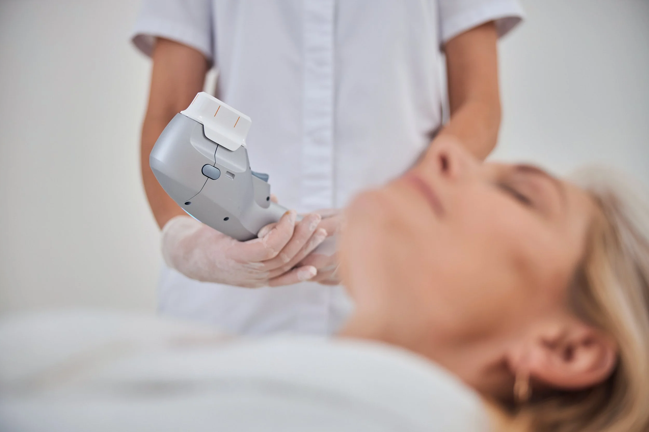 HIFU behandeling gezicht bij vrouwen voor huidverstrakking en rimpelvermindering