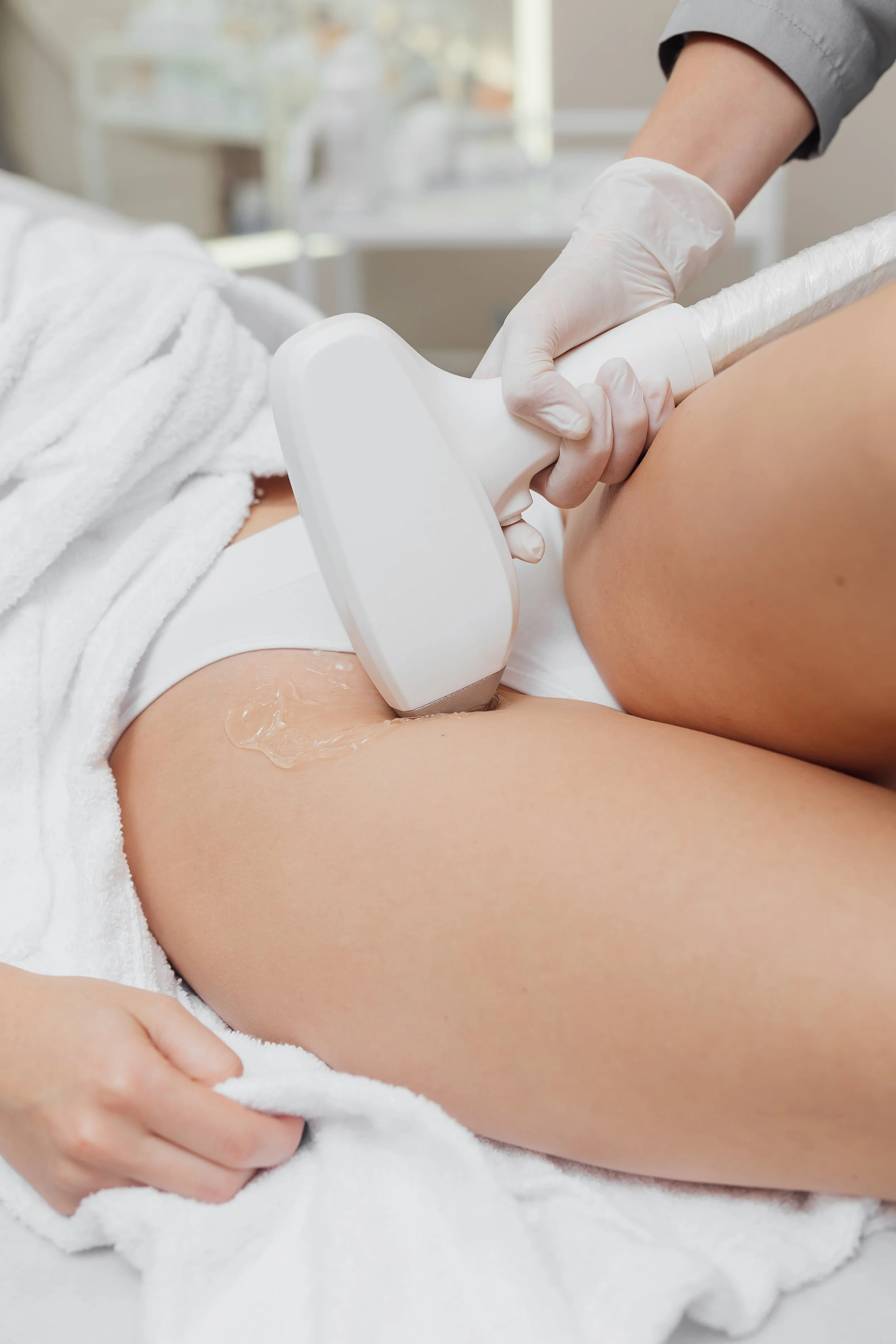 Laser ontharing bikinilijn behandeling in Almere