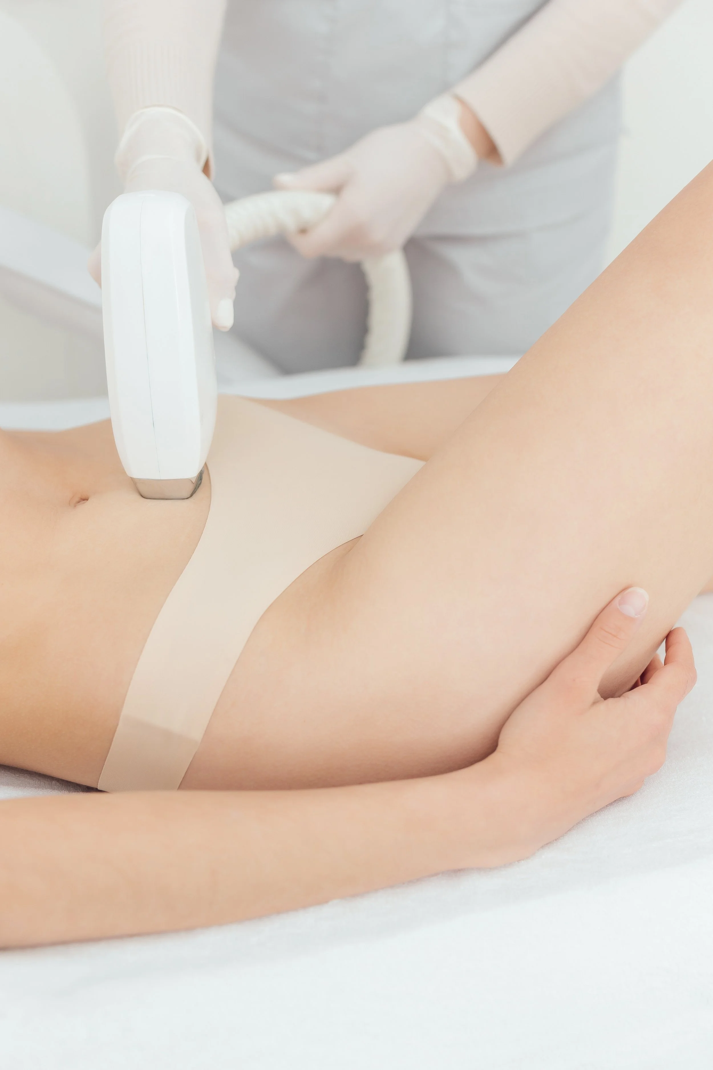 Laser ontharing buik behandeling in Almere