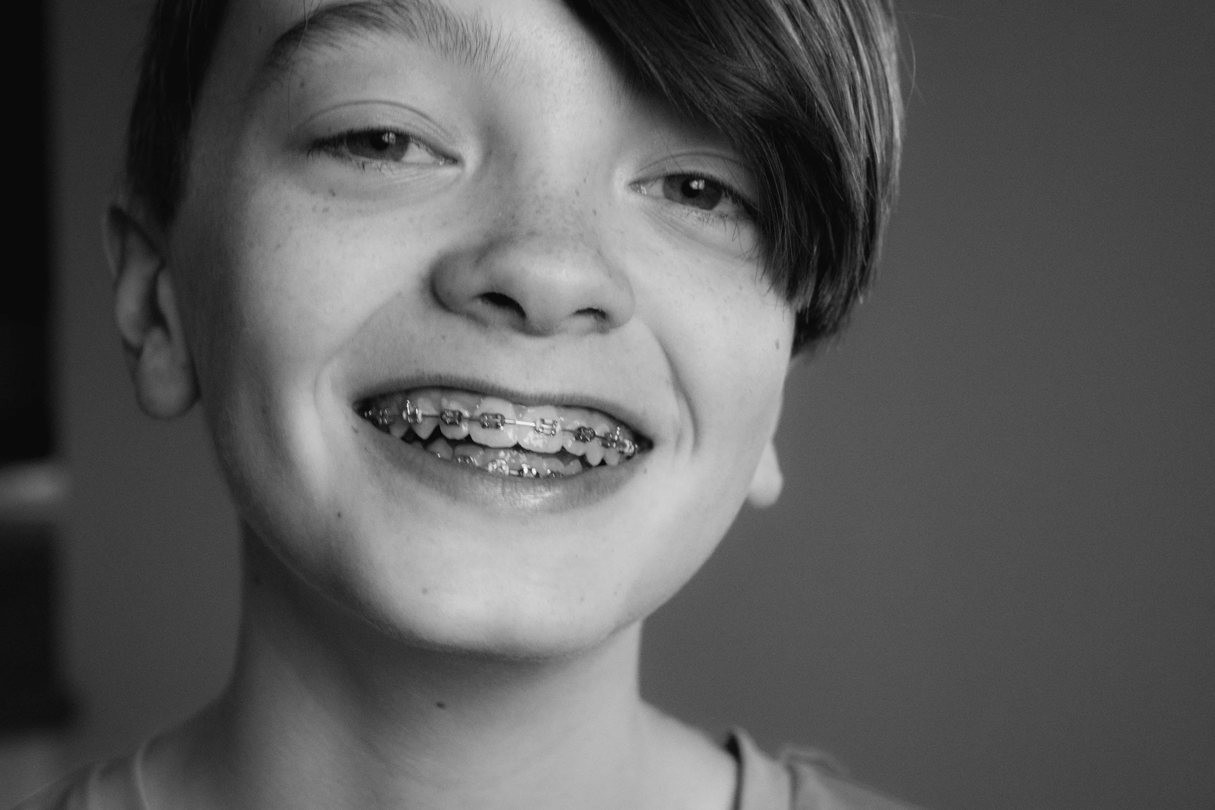 Embracing Orthodontics: A Parent's Guide to Braces for Kids