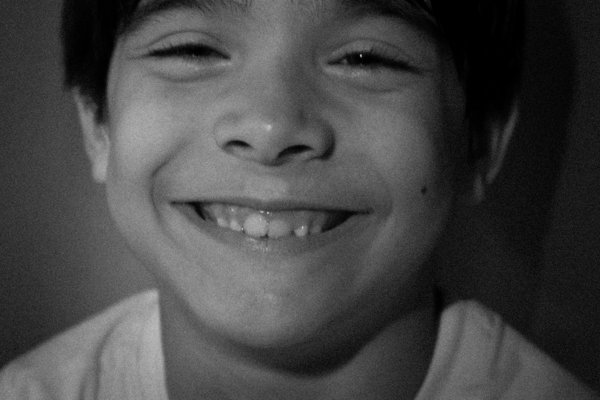 When to Worry About Misaligned Teeth in Children: Expert Advice from a Kids Dentistry Practice in Paradise Valley, AZ