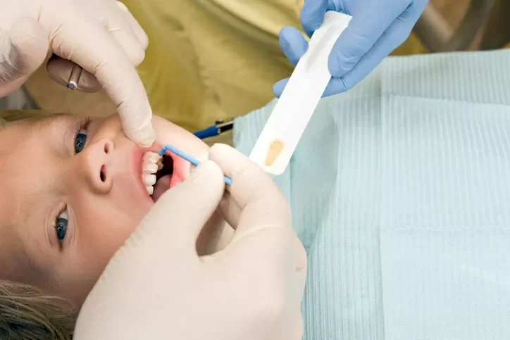 The Top 3 Things You Should Know About Fluoride for Your Child's Dental Health