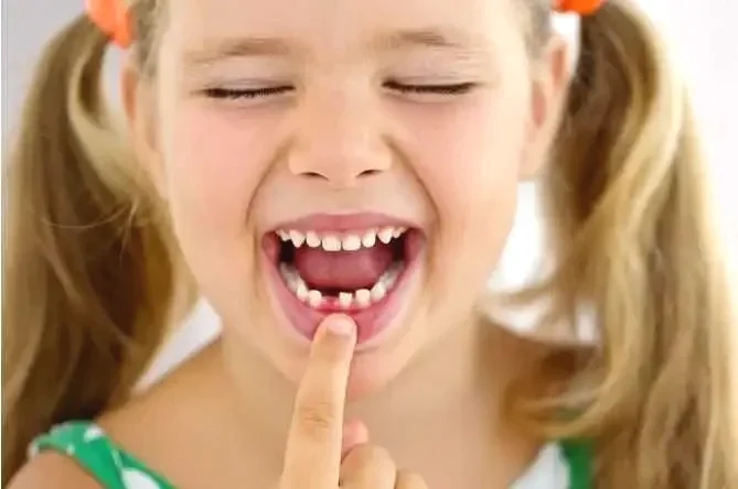 The Rare Condition That Can Make Kids Lose Baby Teeth Too Early: Hypophosphatasia