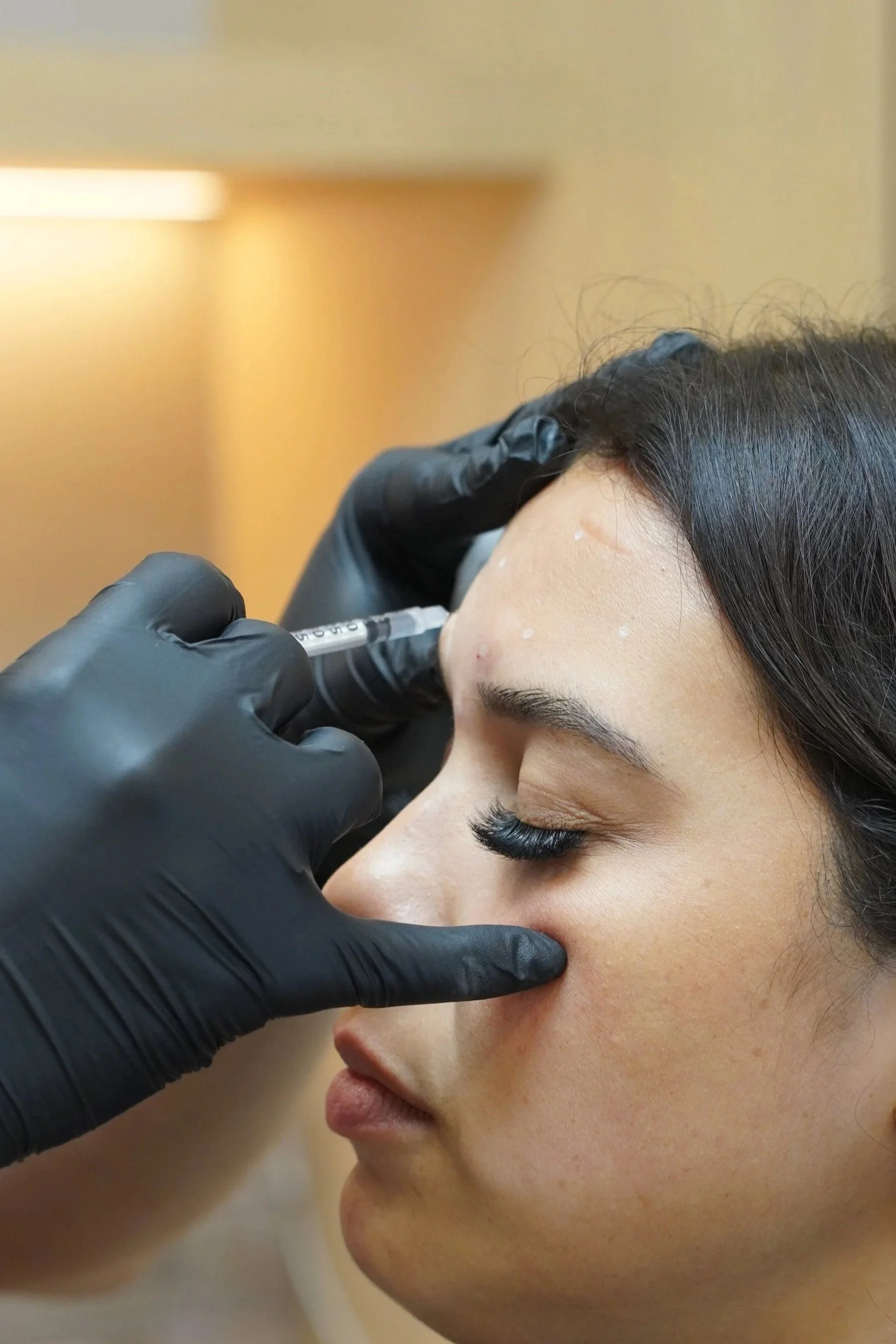 A woman receiving a botox / dysport injection in her forehead from a professional wearing black gloves.