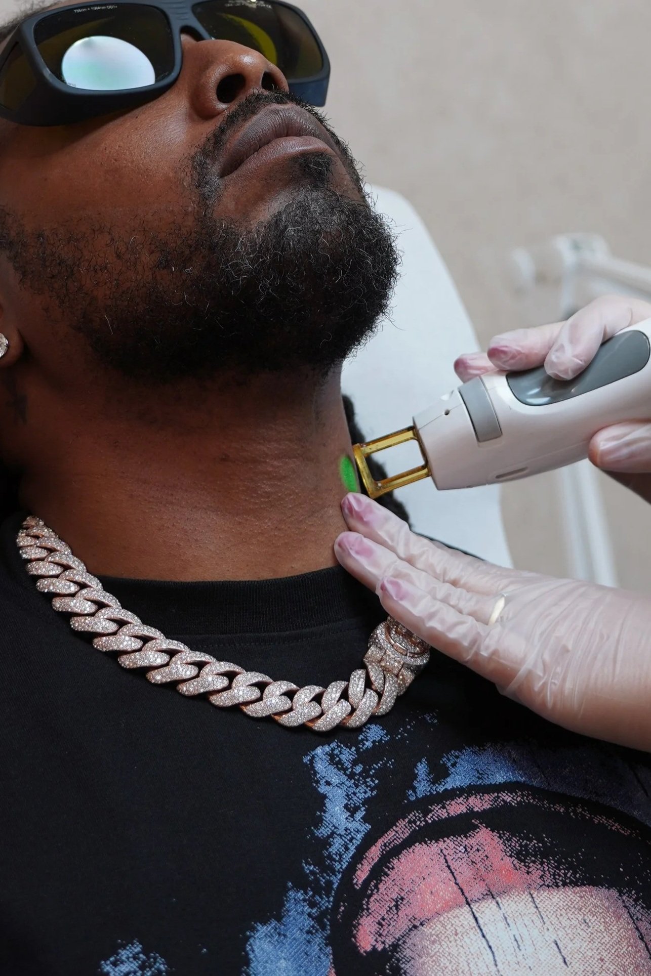 a dark skin/ African American male getting laser hair removal with the gental max pro from candela