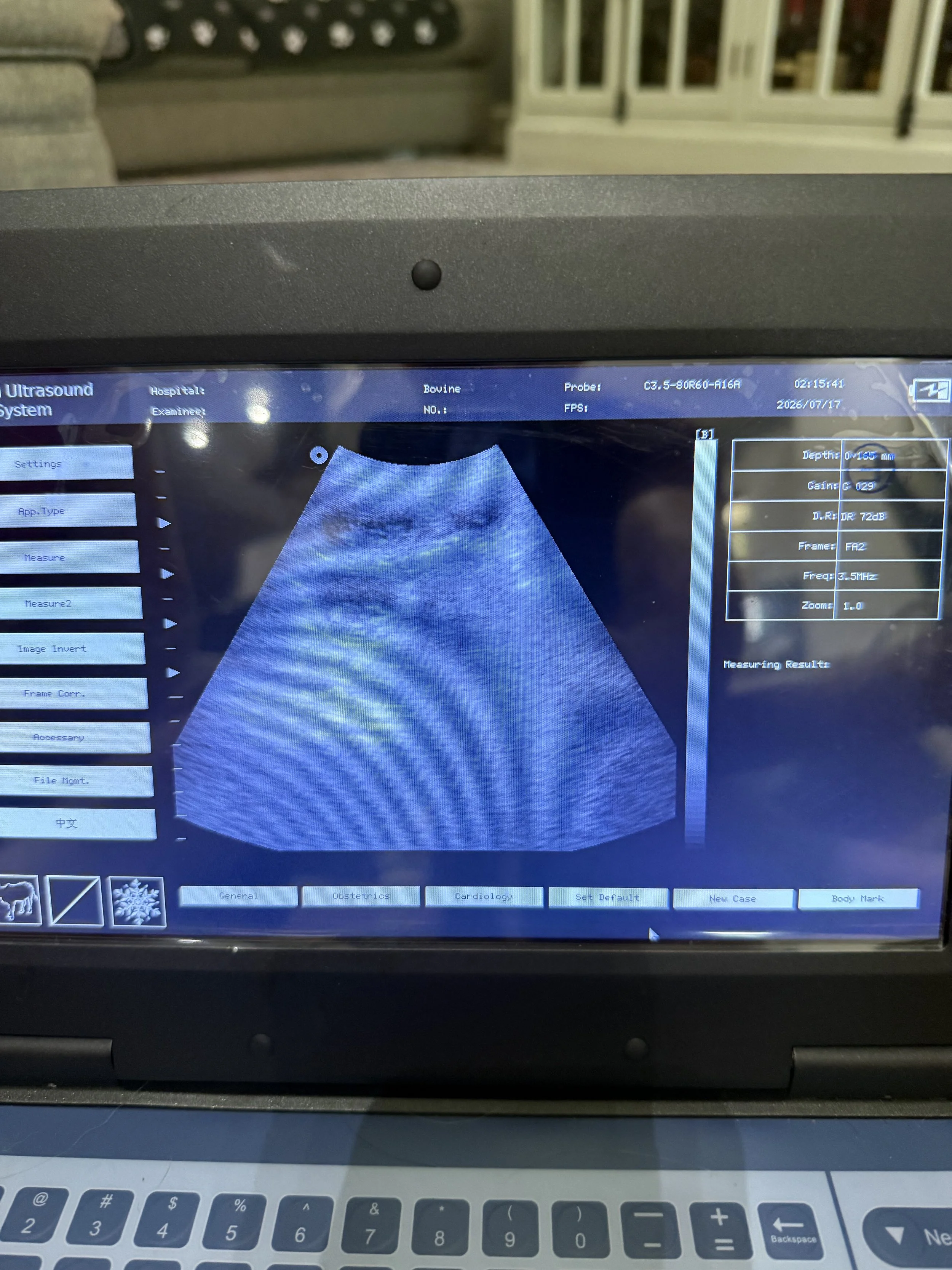 Ultrasound machine screen showing a black and white ultrasound image of an organ, with settings and information displayed on the sides.
