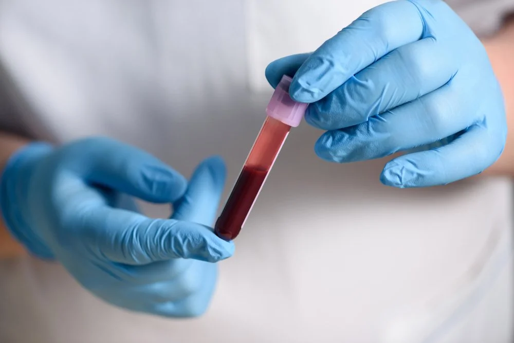 Do You Need More Than a Complete Blood Count Lab?