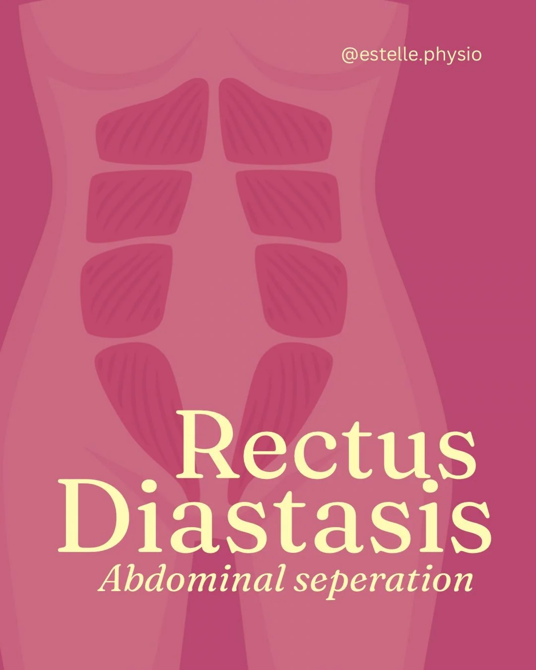 Rectus diastasis (DRAM) is the width of the linea alba between your abdominal muscles (the 6 pack). Some people naturally will have an abdominal separation, and it can be caused by a variety of things. But particularly during pregnancy your tummy mus